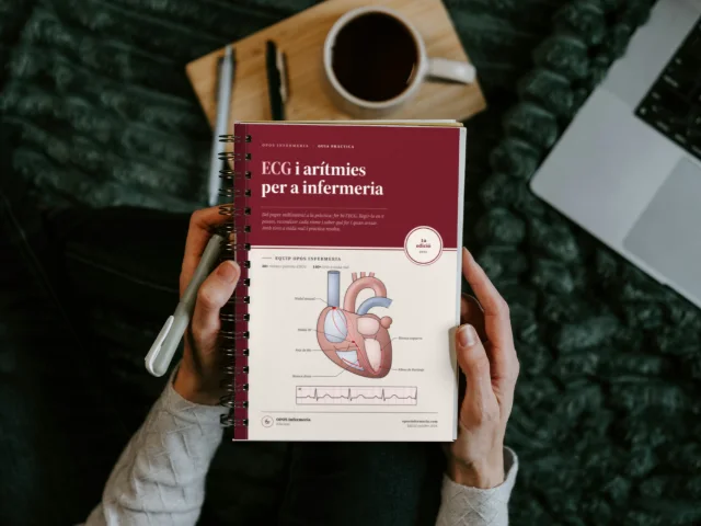 ECG i arítmies per a infermeria, versió impresa: anelles